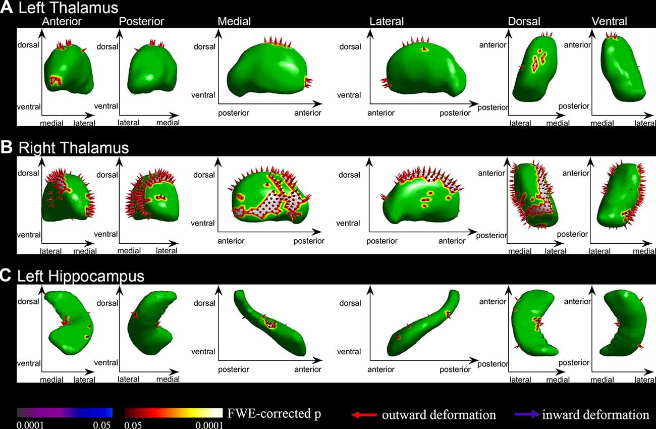 Dollar uitvoeren pack Frontiers | Brain Cortical Complexity and Subcortical Morphometrics in Lifelong Premature Ejaculation Dollar uitvoeren pack Frontiers | Brain Cortical Complexity and Subcortical Morphometrics in Lifelong Premature Ejaculation