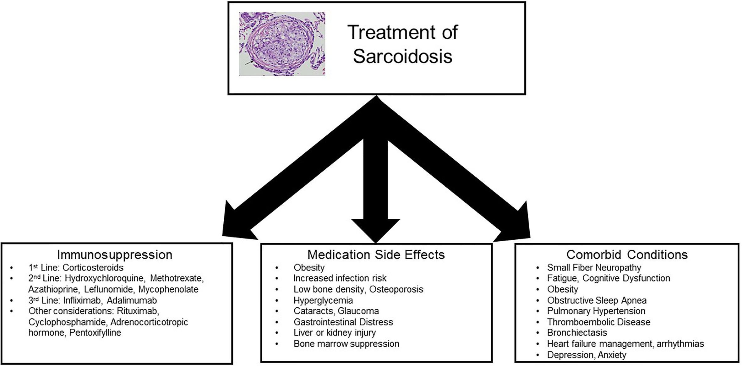 Саркоидоз мкб 10 у взрослых. Саркоидоз схема. Sarcoidosis treatment Guidelines. Саркоидоз мкб 10.