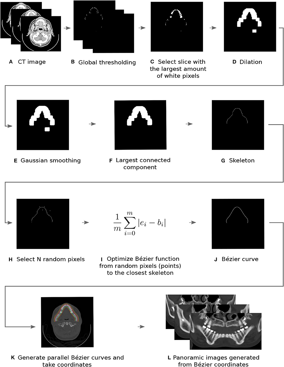 Frontiers Reconstruction Of Panoramic Dental Images Through Bezier Function Optimization Bioengineering And Biotechnology