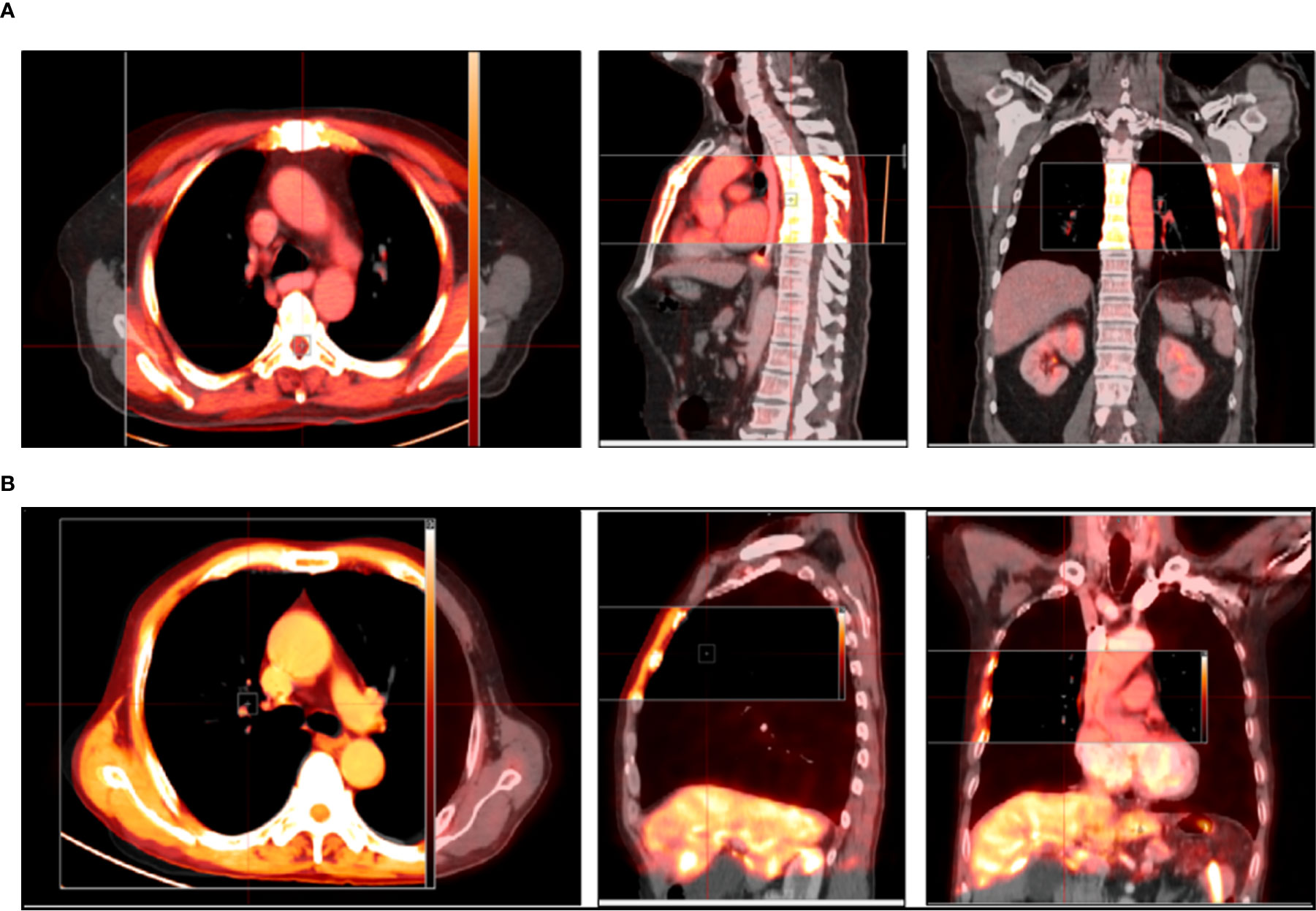 Frontiers Comparison Of The Gross Target Volumes Based On Diagnostic