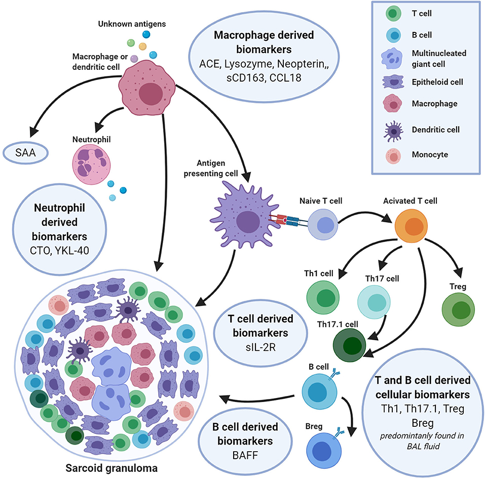 Биомаркеры это. Биомаркеры инфекционных заболеваний. Саркоидоз иммунология. Саркоидоз патогенез схема. Сенсоры определяющие биомаркеры.