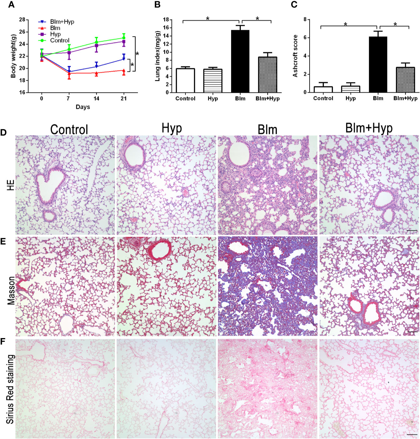 Frontiers hyperoside attenuates bleomycin induced pulmonary fibrosis