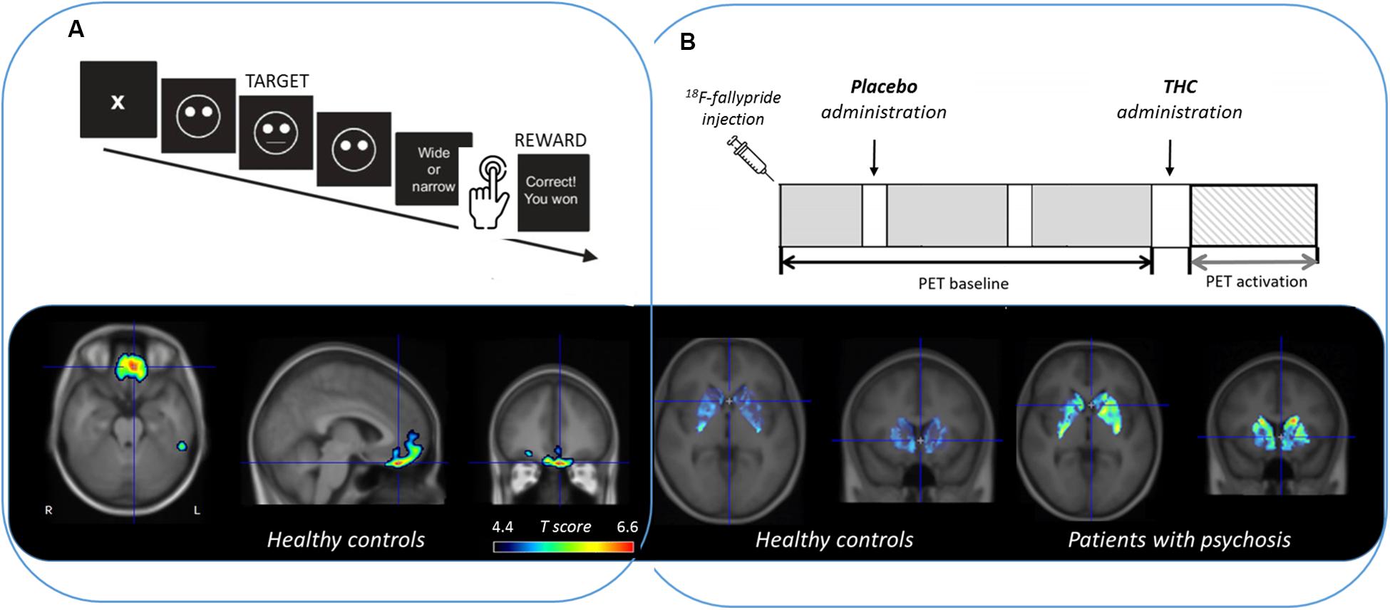 New Dopamine Test May Allow for Earlier Detection of Neurological