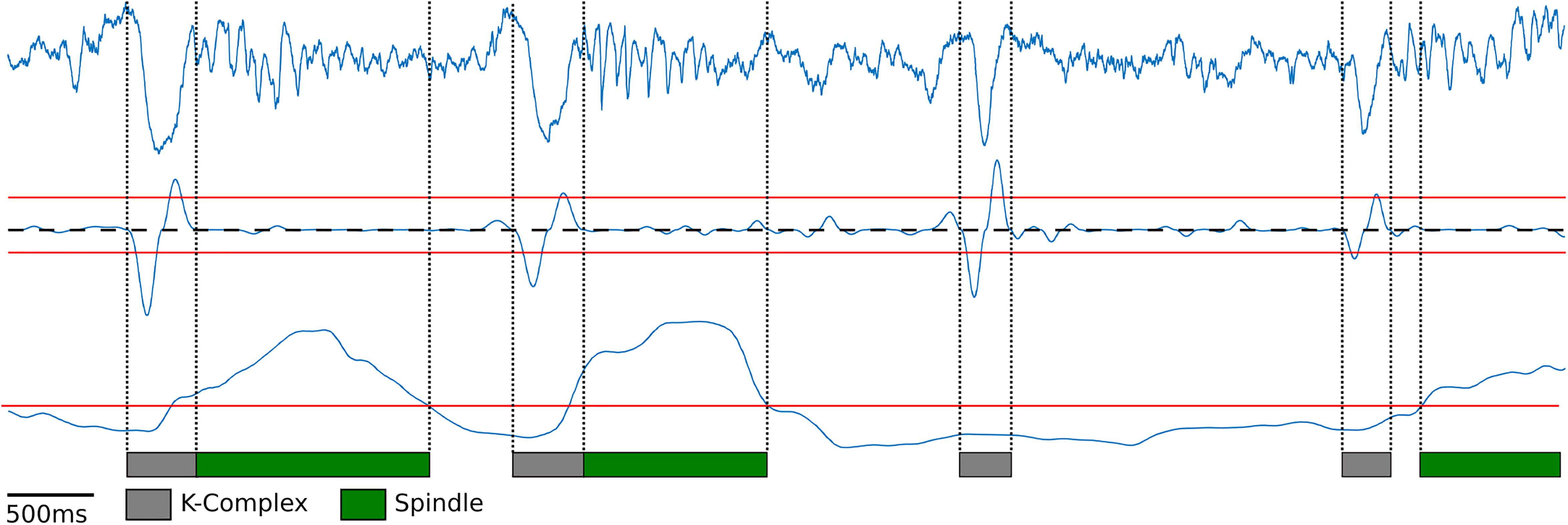 Frontiers Assessment of Sleep, and Sleep Spindles in a