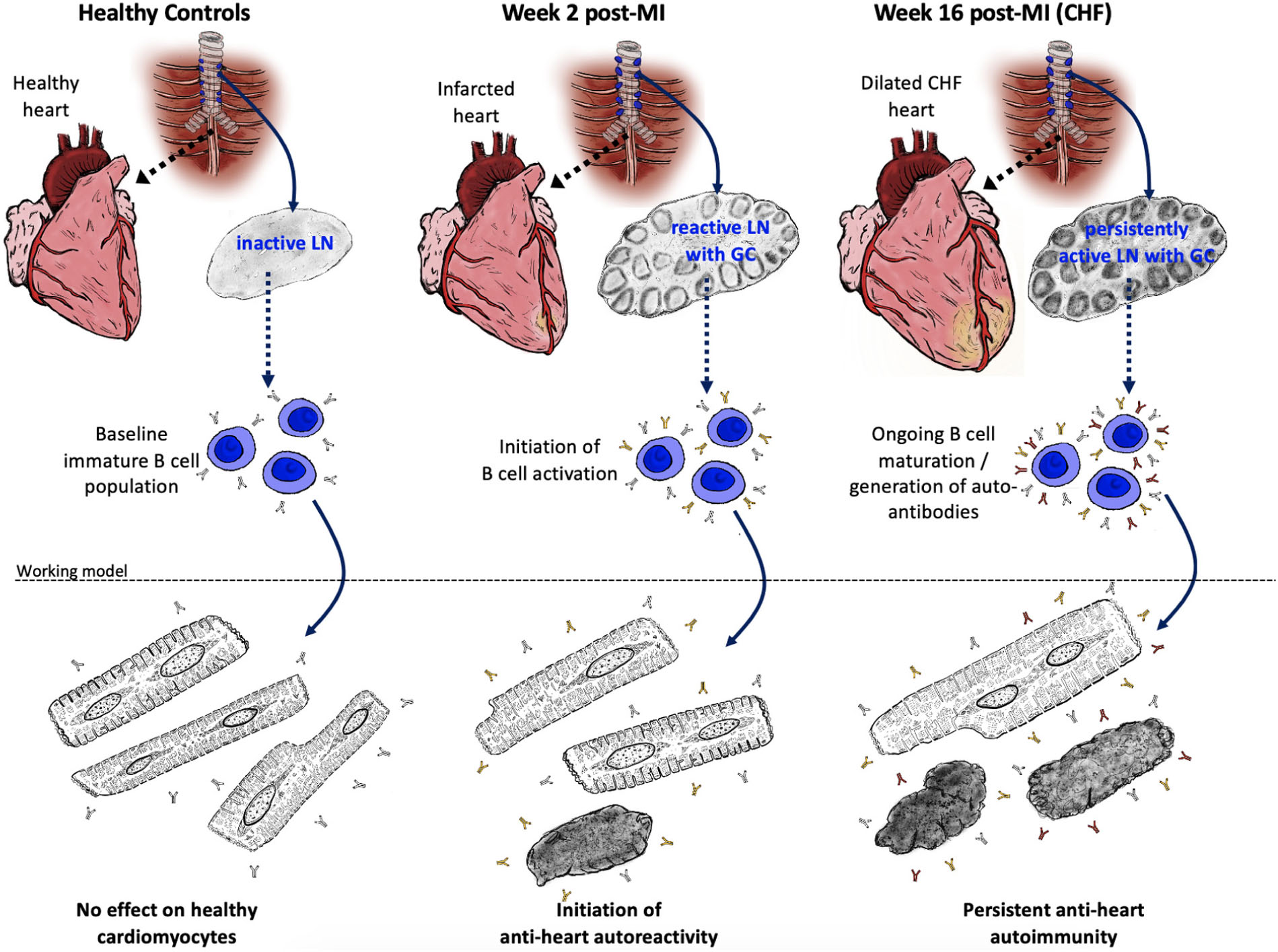 Frontiers Mediastinal Lymphadenopathy Class Switched Auto Antibodies