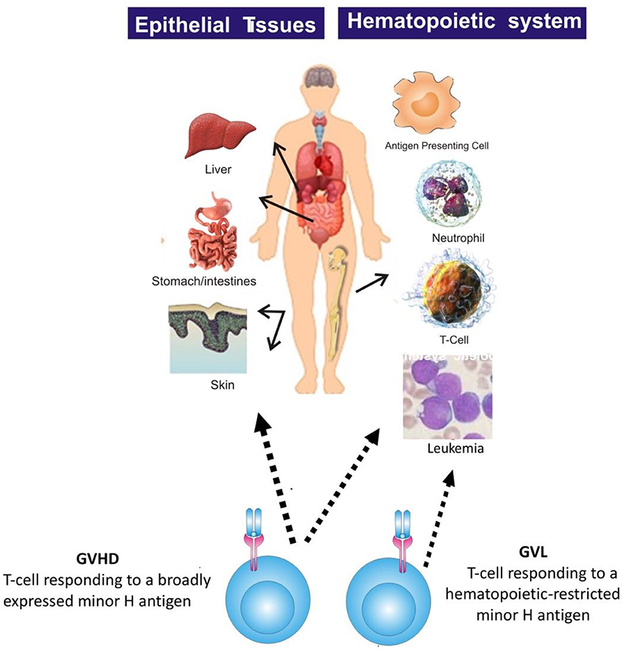 Frontiers Minor Histocompatibility Antigen Specific T Cells Pediatrics
