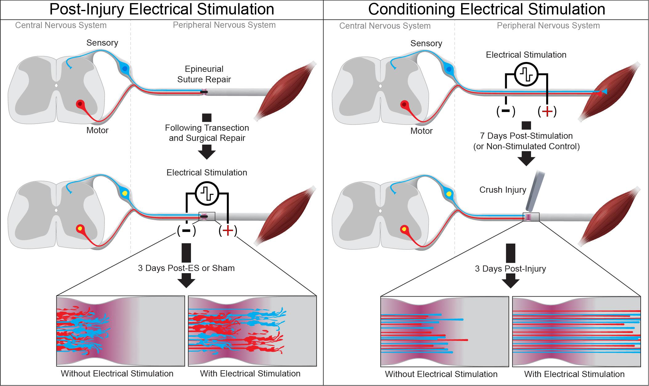 Newly invented electrical stimulation (ES) device improves nerve  regeneration in humans