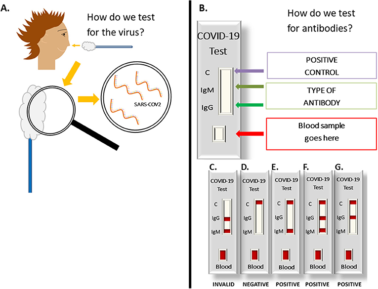 Figure 3 - How does a coronavirus test work? (A) How do we test for the virus?: A small sample of fluid is collected from the nose with a swab, and then the medical team looks for the genetic sequence of SARS-CoV-2 in the sample.