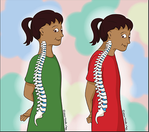 Figure 1 - An anatomically neutral posture is shown on the left.