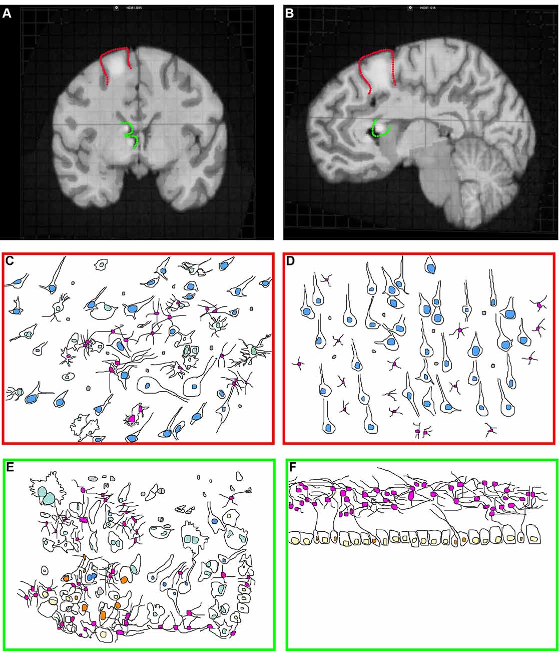 Frontiers  The Neurodevelopmental Pathogenesis of Tuberous Sclerosis  Complex (TSC)