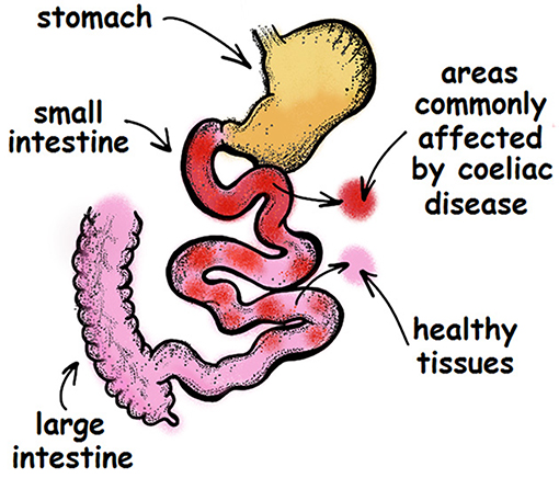 Figure 1 - The lower digestive tract.