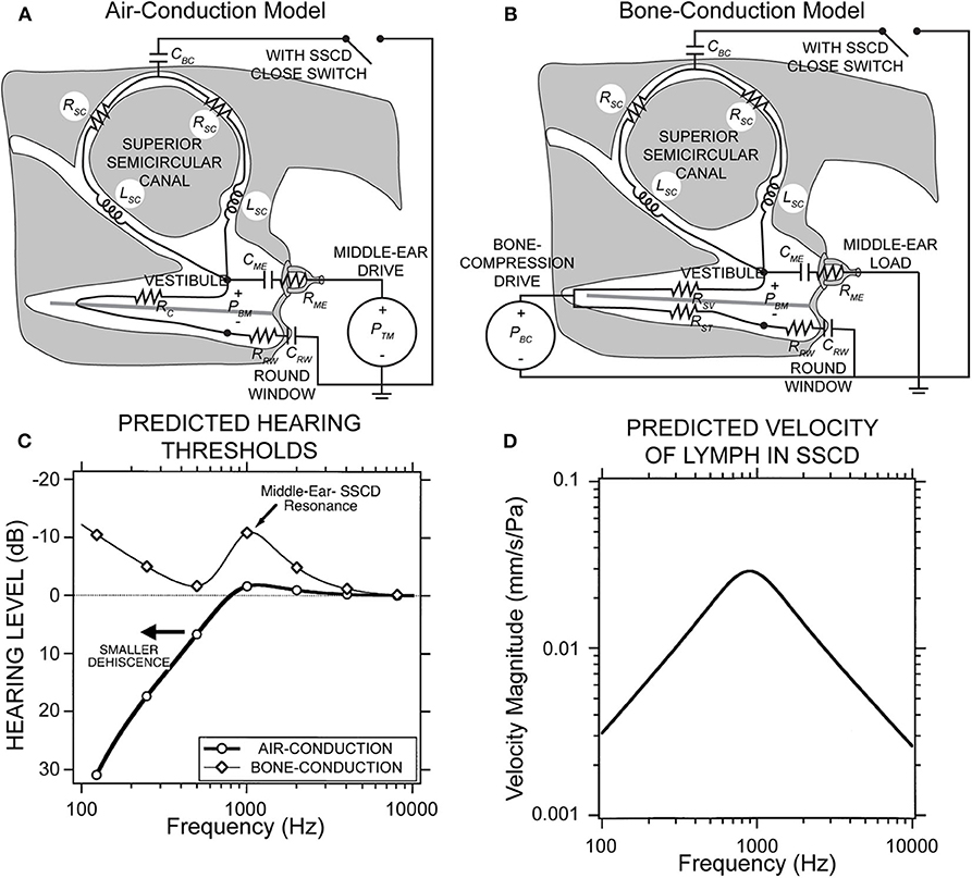 Frontiers  Audiovestibular Quantification in Rare Third Window