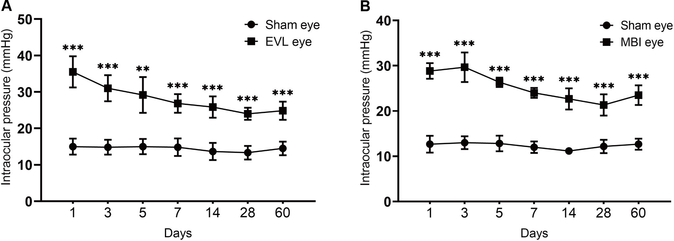 What is Intraocular Pressure (IOP)? - Nanodropper