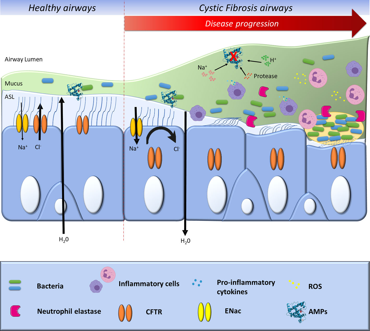 Relative Increase in IgG Antibodies to Pseudomonas aeruginosa 60-kDa GroEL  in Prediabetic Patients with Cystic Fibrosis