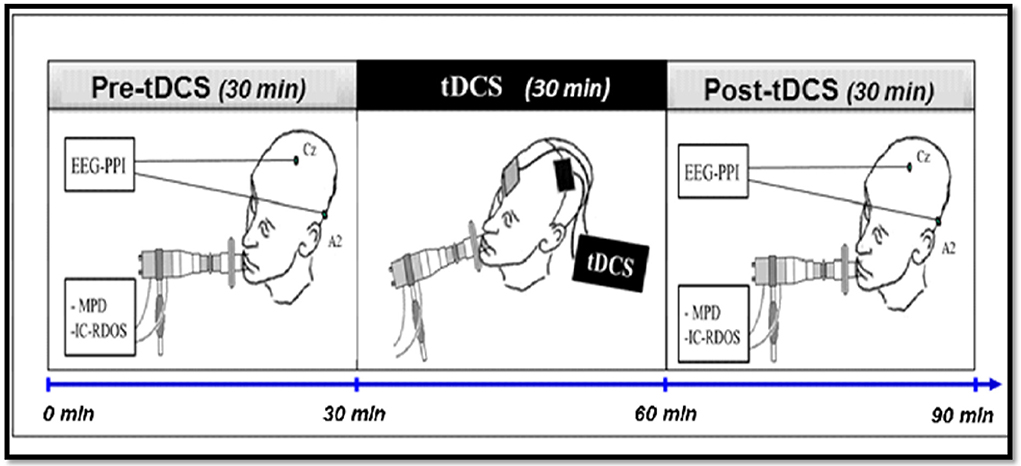 Frontiers  Randomized Controlled Study Evaluating Efficiency of Low  Intensity Transcranial Direct Current Stimulation (tDCS) for Dyspnea Relief  in Mechanically Ventilated COVID-19 Patients in ICU: The tDCS-DYSP-COVID  Protocol