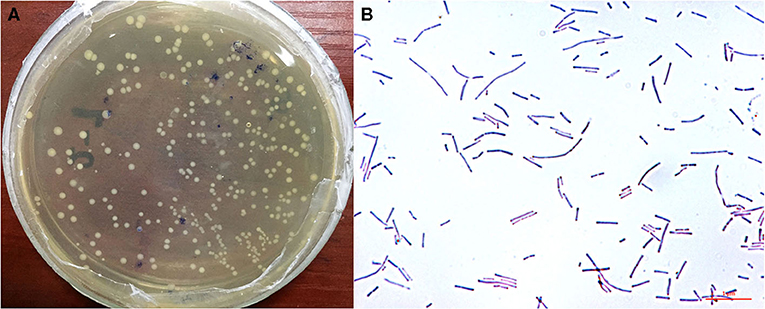 Lactobacillus reuteri под микроскопом. Лактобациллы на стекле. Lactobacillus fermentum 11 штамм. Лактобациллус хелветикус.