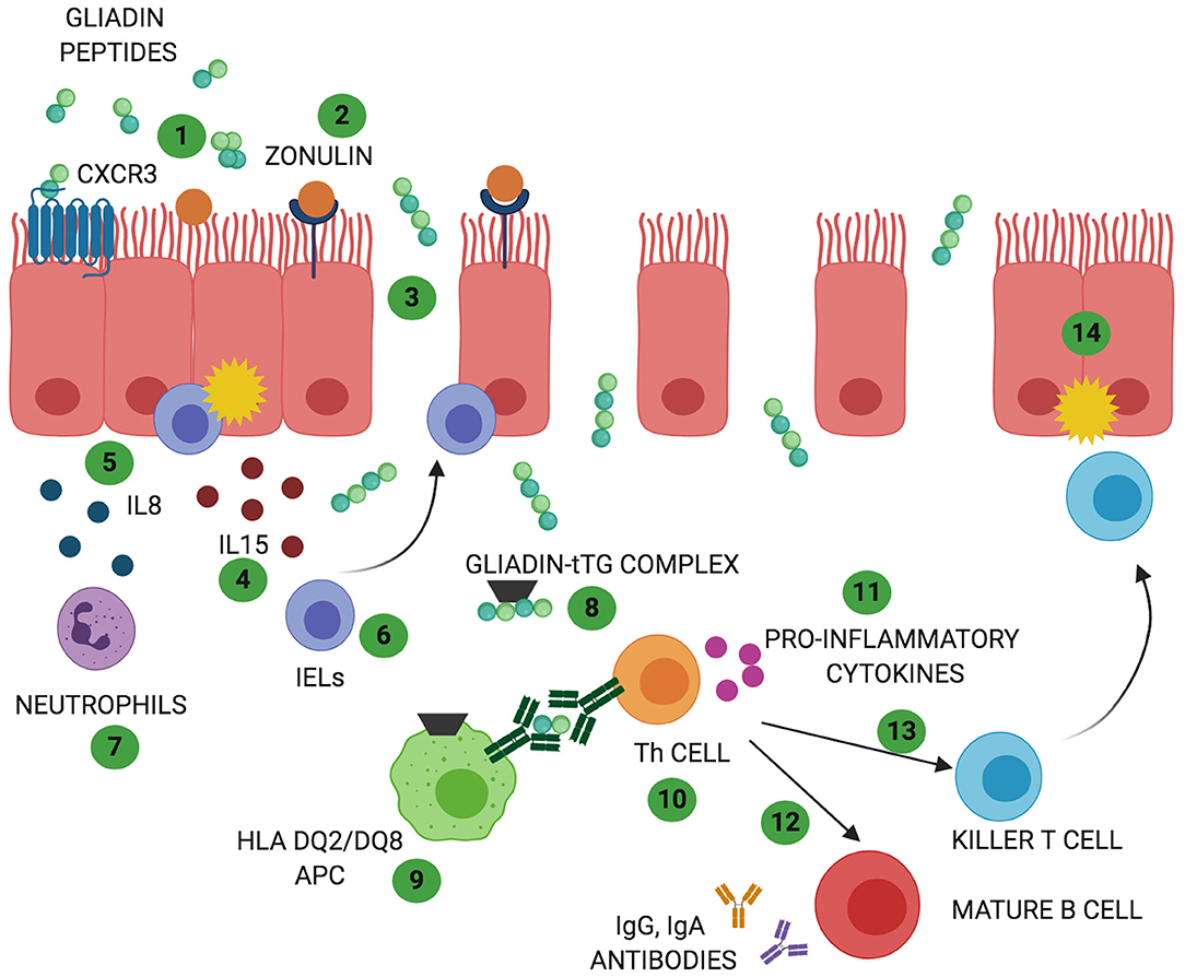 Frontiers | Celiac Disease and Non-celiac Wheat Sensitivity: State of Art  of Non-dietary Therapies | Nutrition