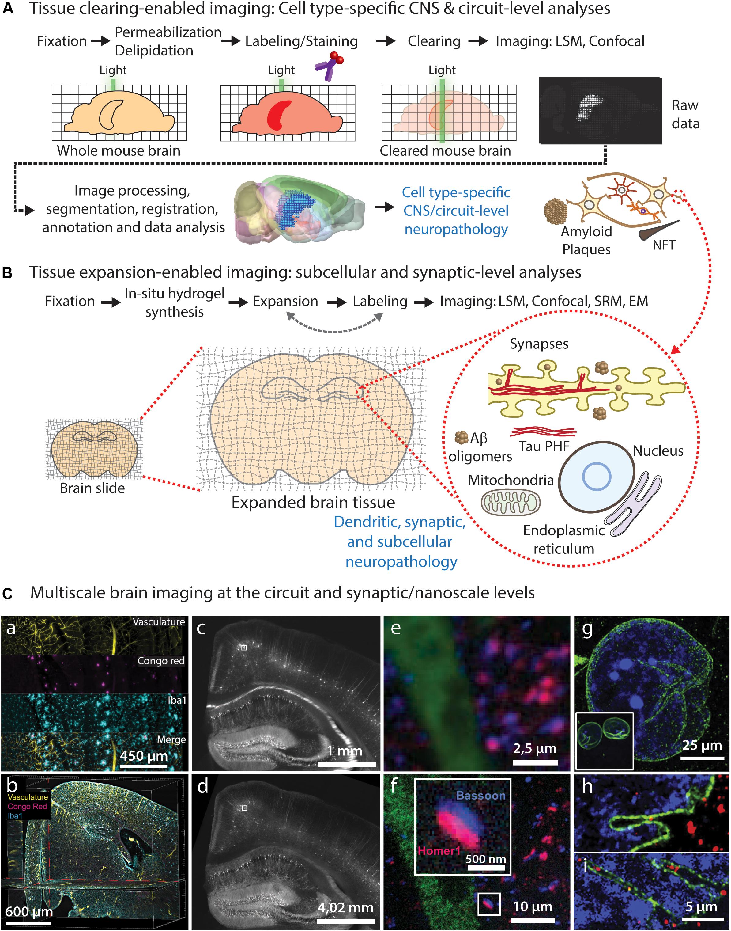 brain tissue research paper
