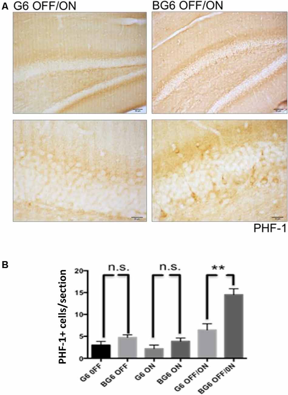 Frontiers Overexpression Of Gsk 3b In Adult Tet Off Gsk 3b Transgenic Mice And Not During Embryonic Or Postnatal Development Induces Tau Phosphorylation Neurodegeneration And Learning Deficits Molecular Neuroscience