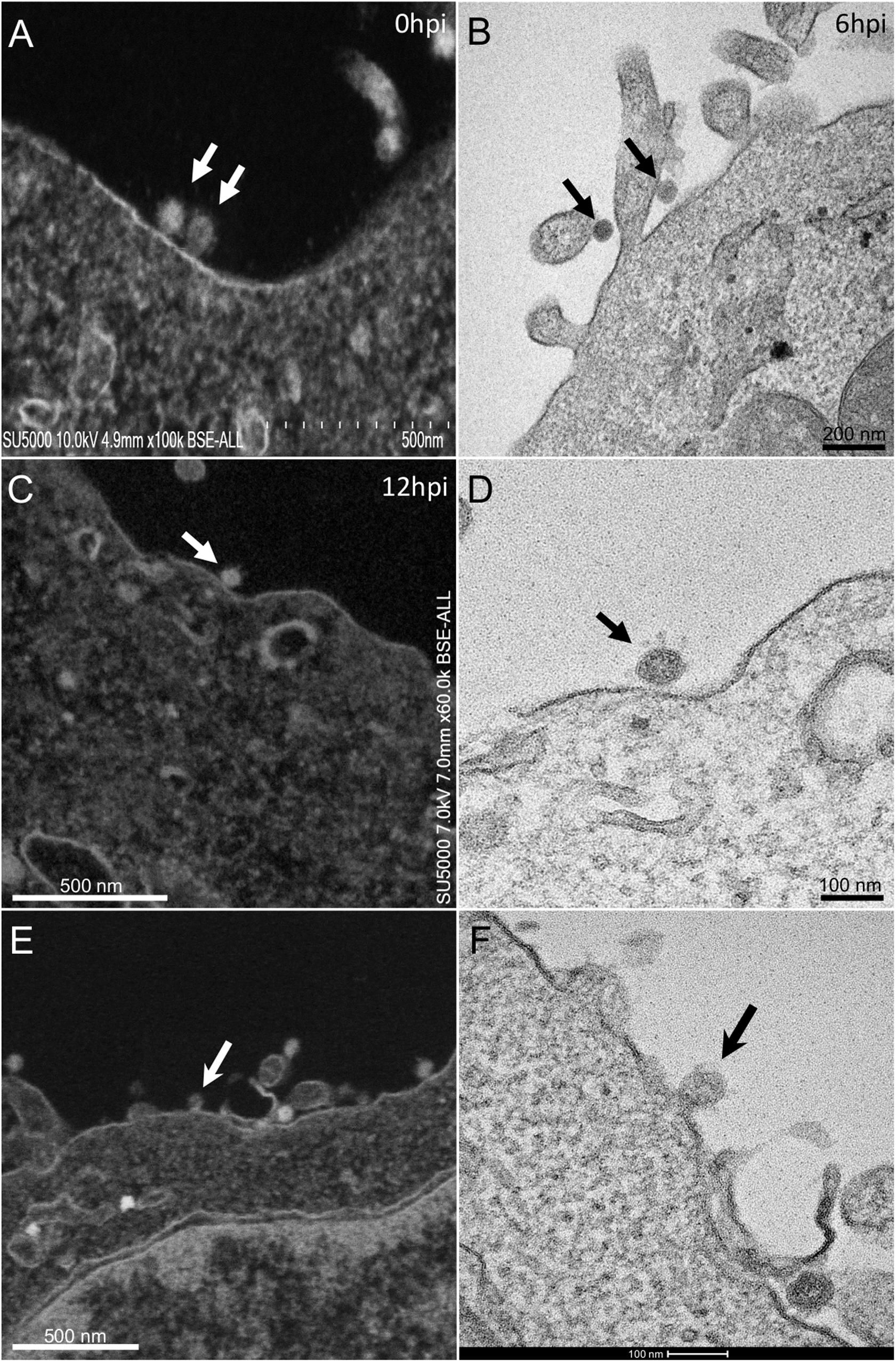 scanning electron microscope virus