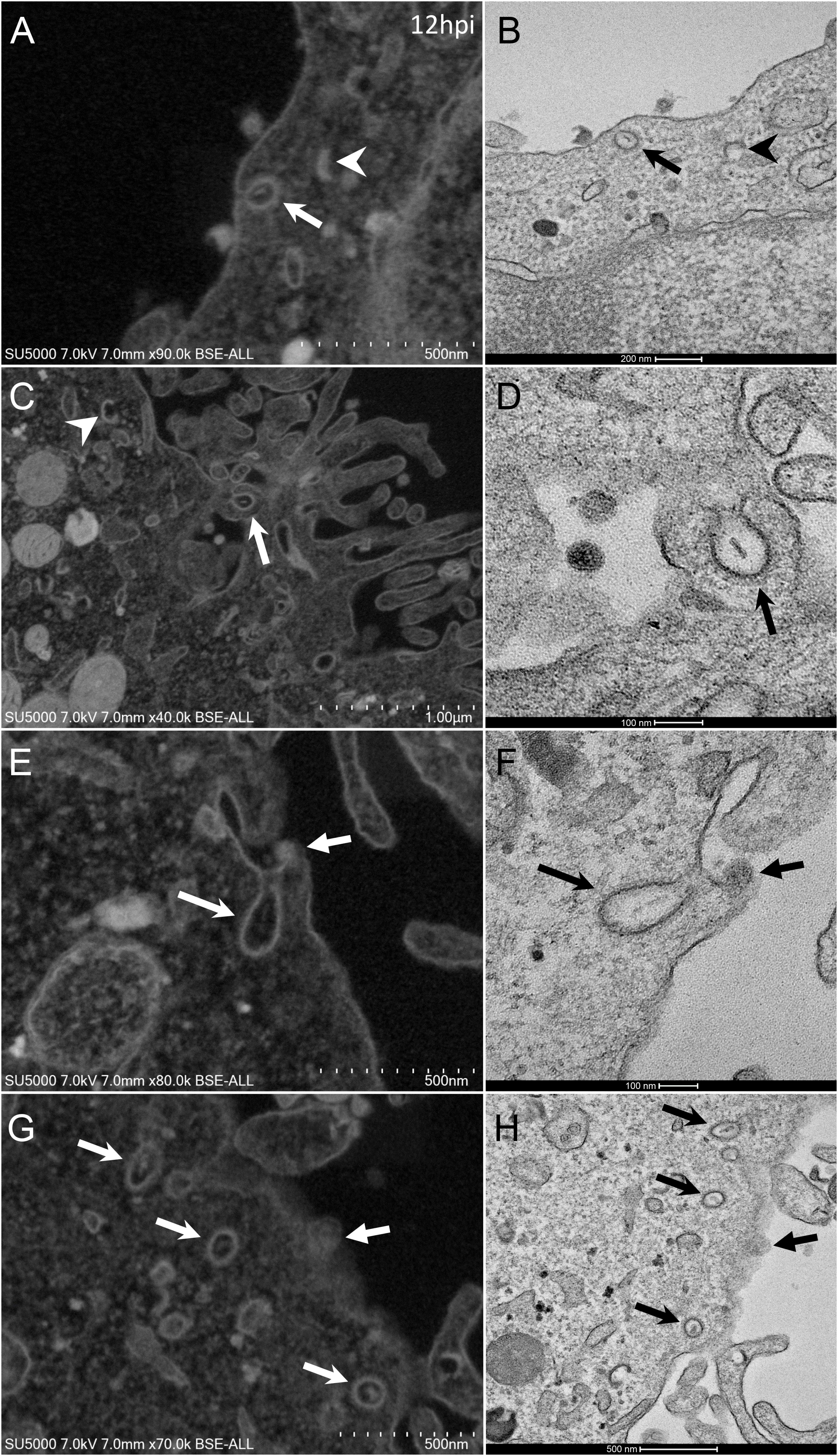 scanning electron microscope virus