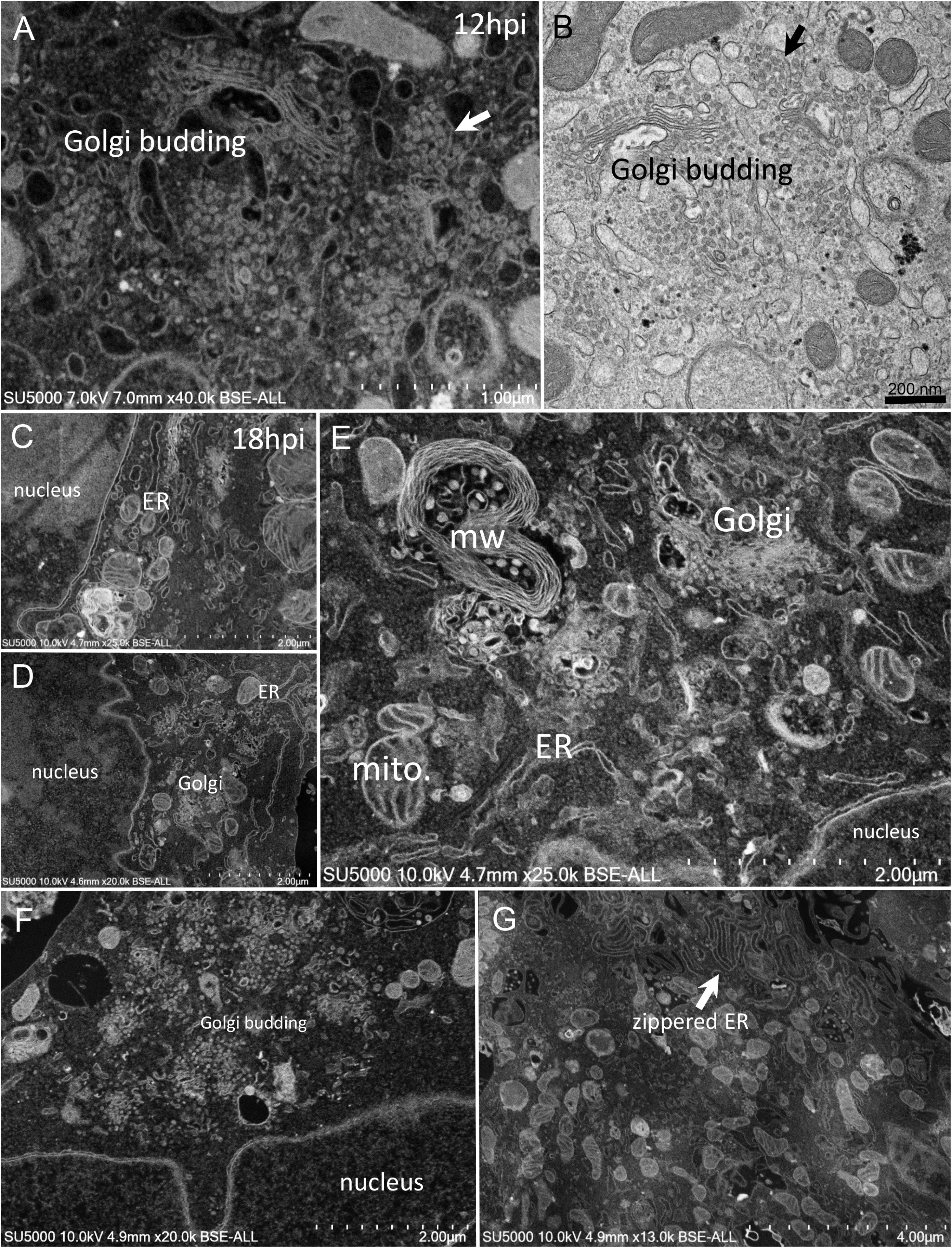 scanning electron microscope virus