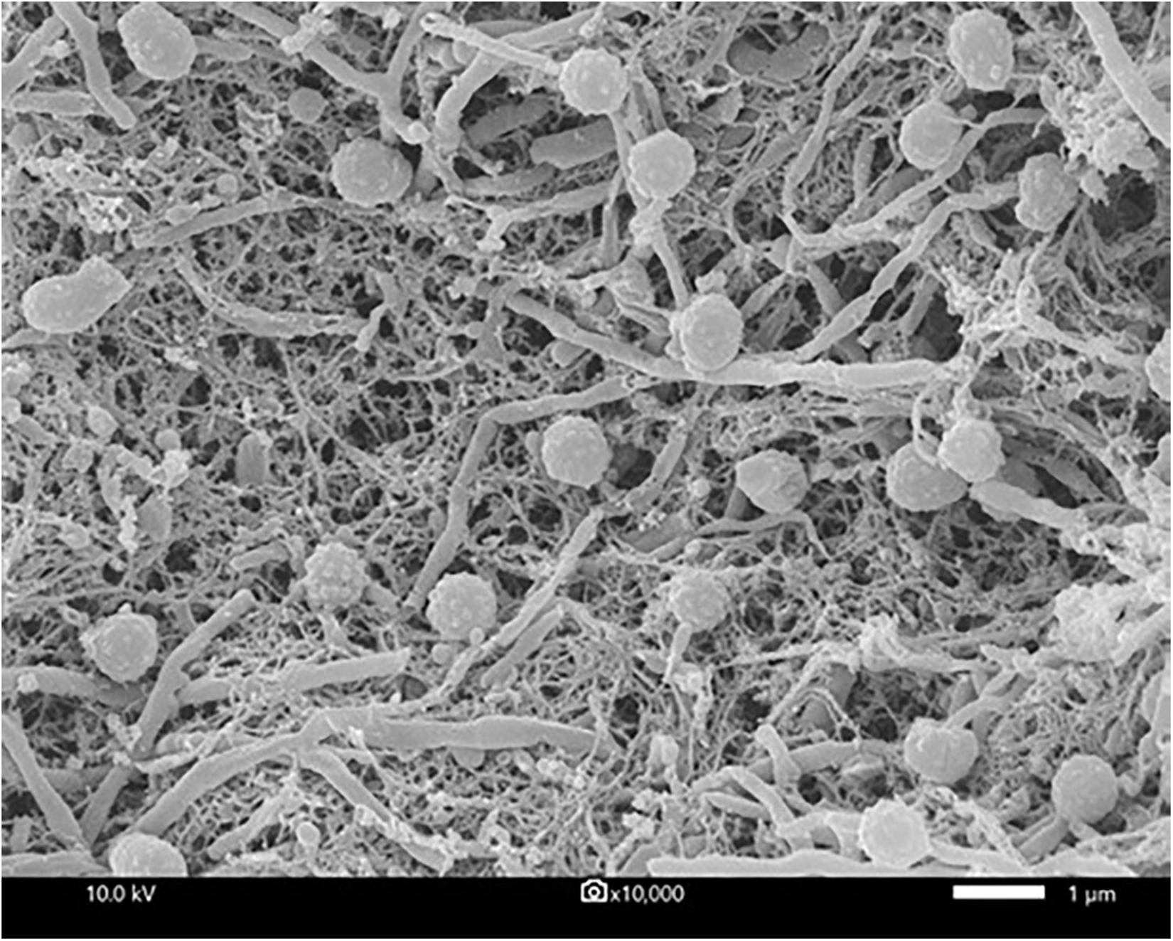Frontiers | Bryophytes Harbor Cultivable Actinobacteria With Plant 