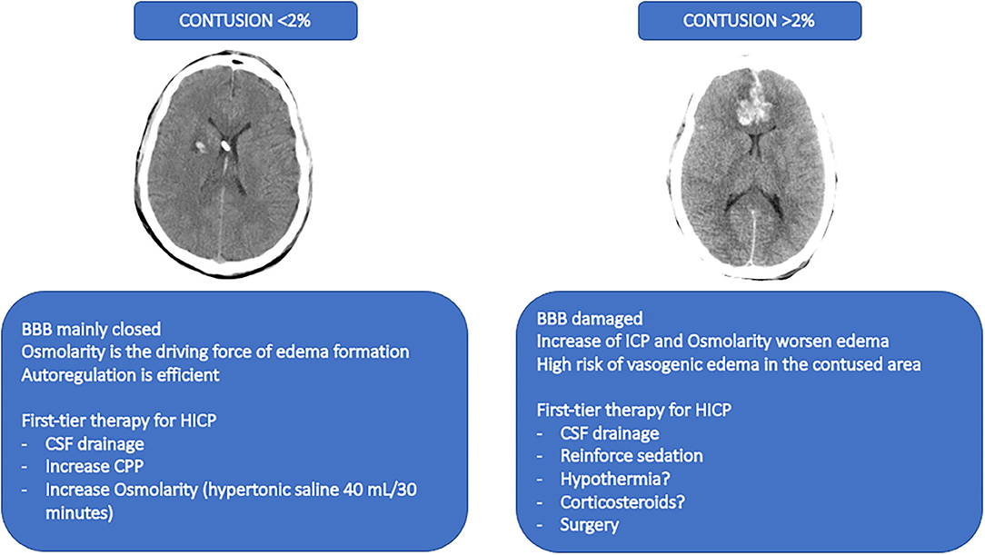 Frontiers | Escalate and De-Escalate Therapies for Intracranial ...