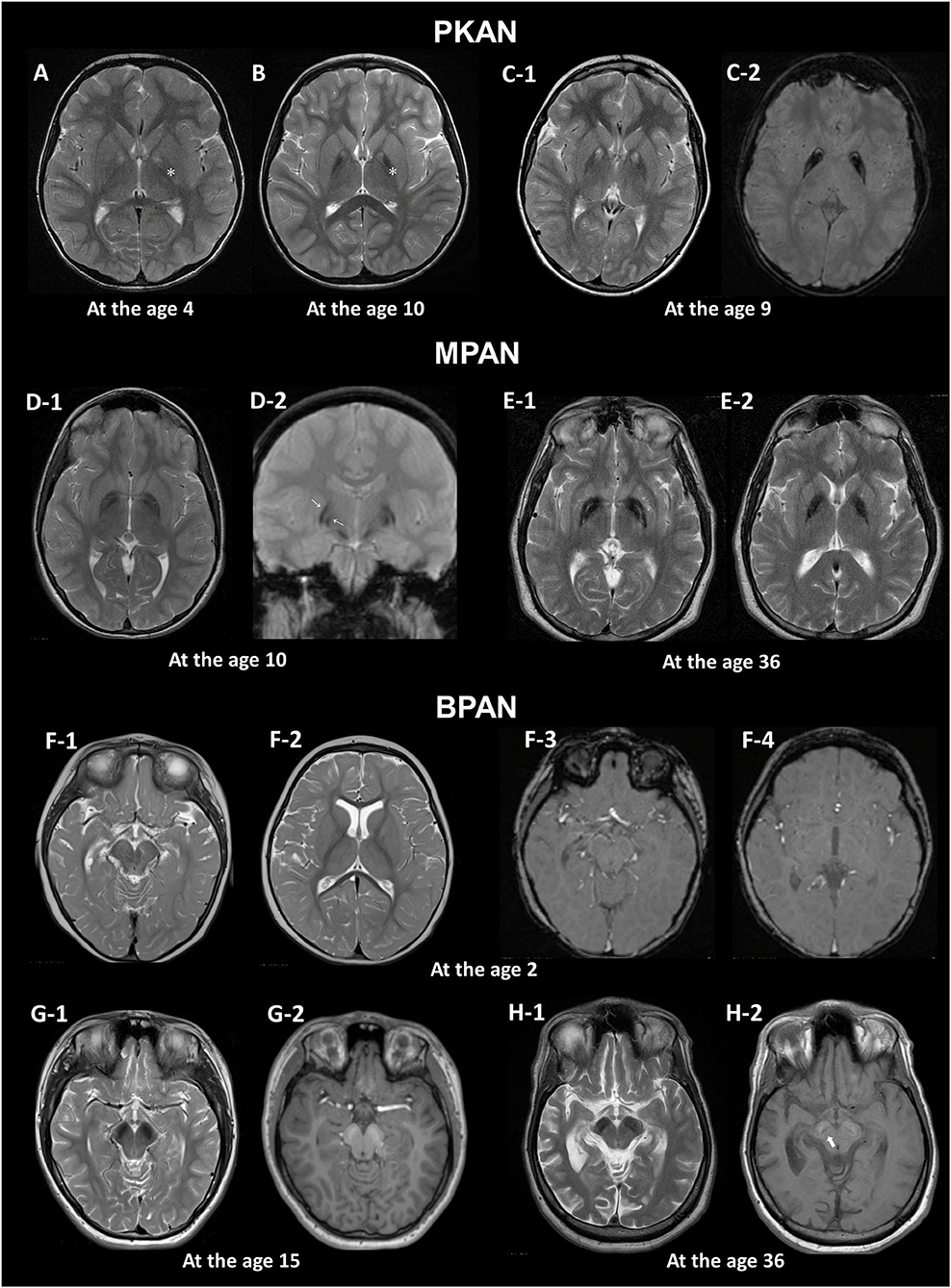 Mri Images Of The Brain