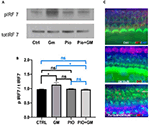 Frontiers | Pioglitazone Ameliorates Gentamicin Ototoxicity by ...