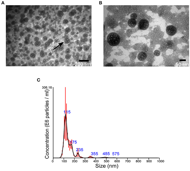 Release of Staphylococcus aureus extracellular vesicles and their  application as a vaccine platform