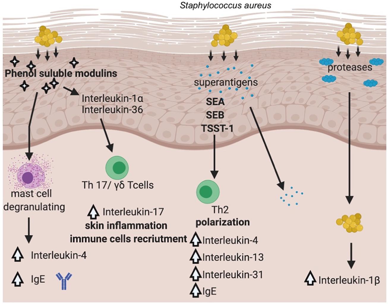 Doctor explains Staphylococcus aureus fatalities and link to eczema