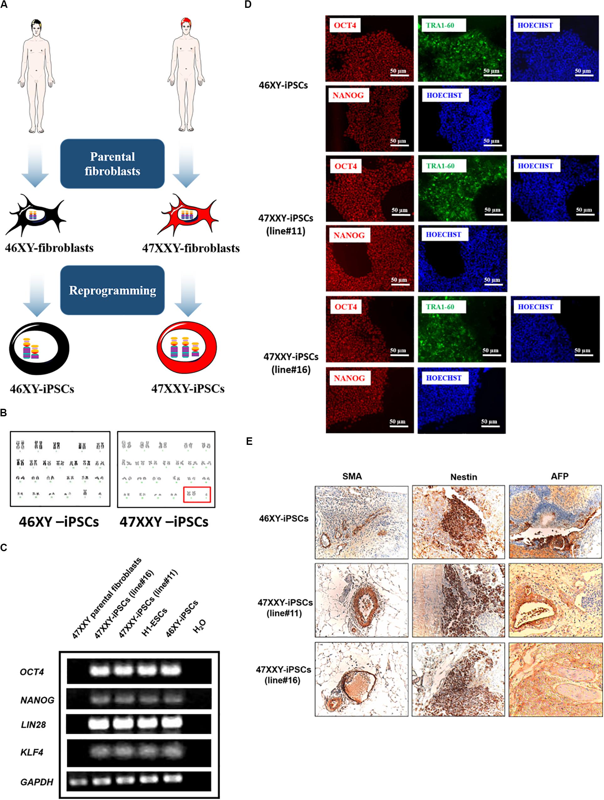 Frontiers Modeling Klinefelter Syndrome Using Induced Pluripotent