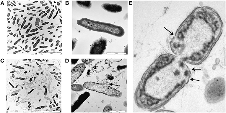Figure 1 - Electron microscopy pictures of bacteria (Pseudomonas aeruginosa) with and without treatment with an AMP originating from hemoglobin [2].