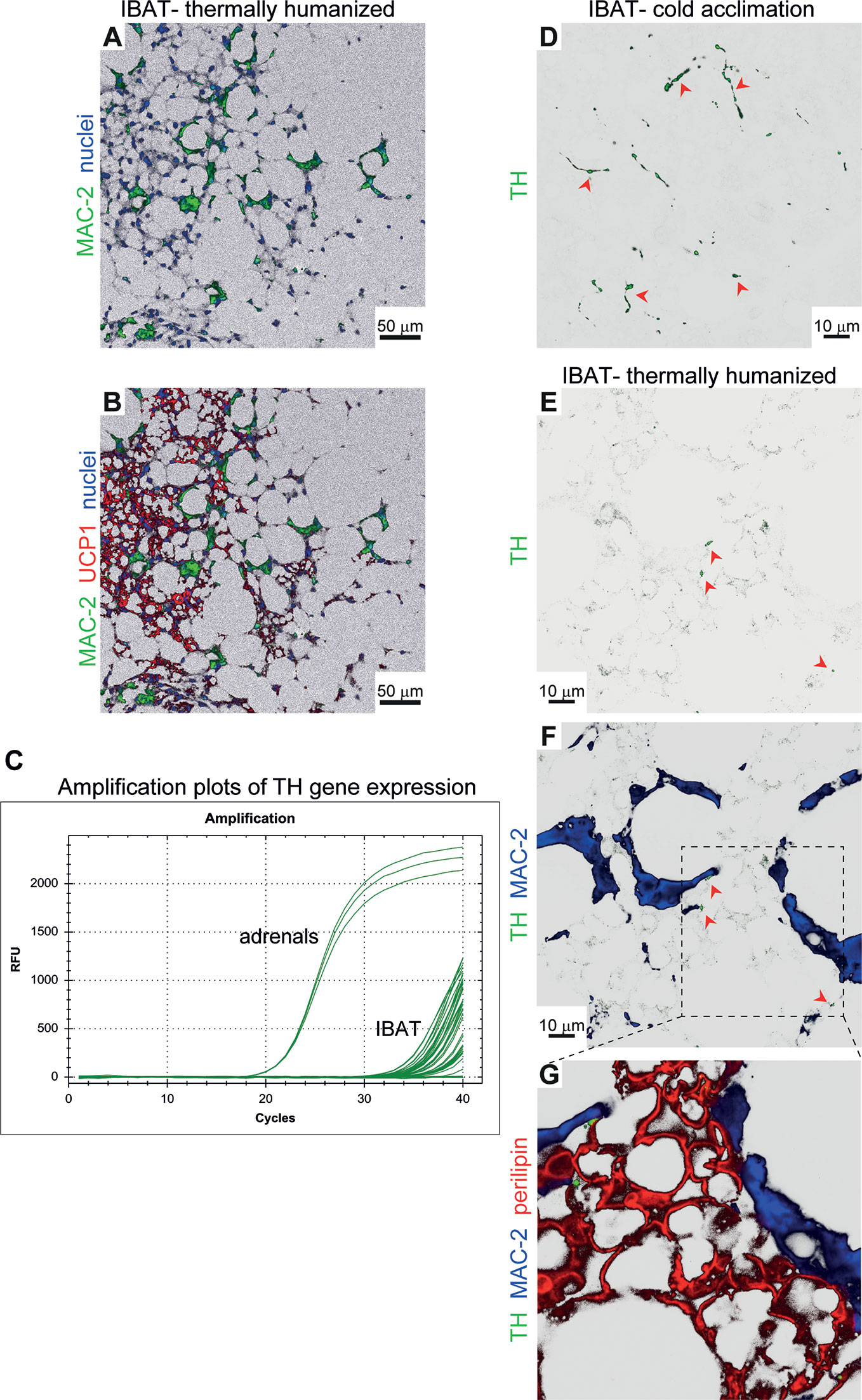 Full article: Comparative transcriptomic analysis of rabbit interscapular  brown adipose tissue whitening under physiological conditions