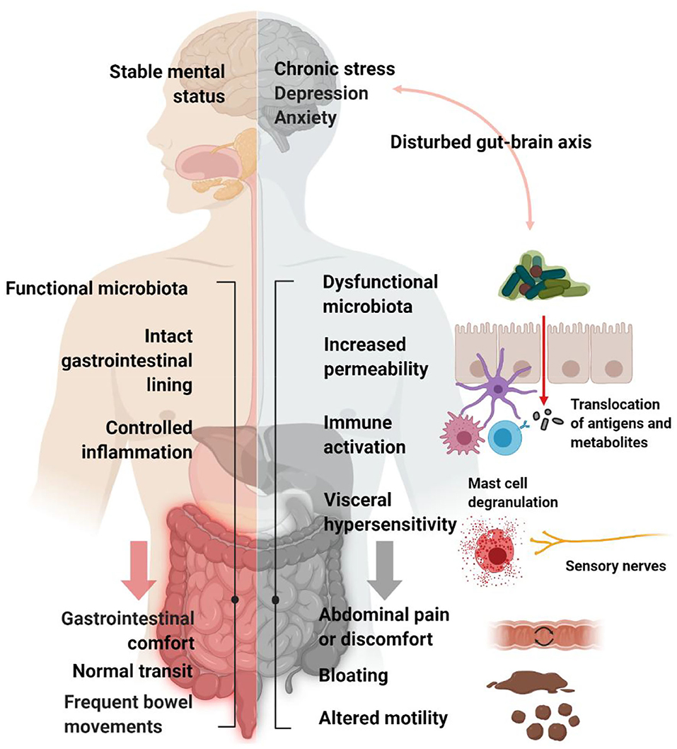 ibs stool shape