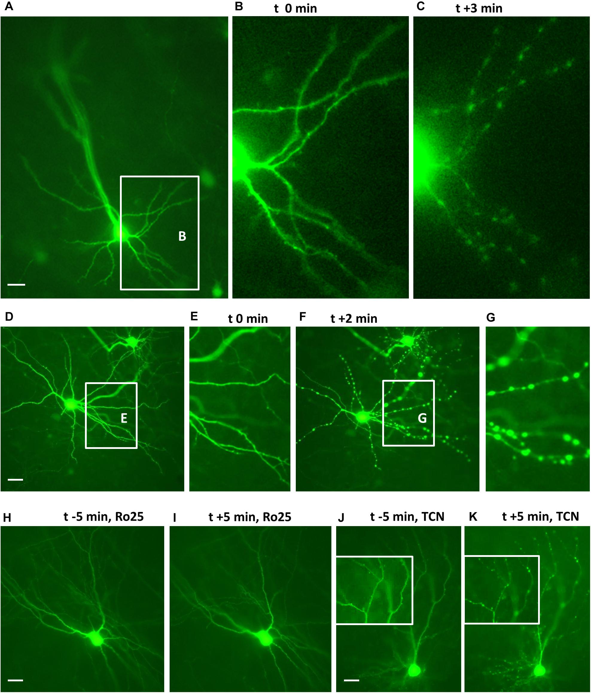 Frontiers  GluN2B but Not GluN2A for Basal Dendritic Growth of