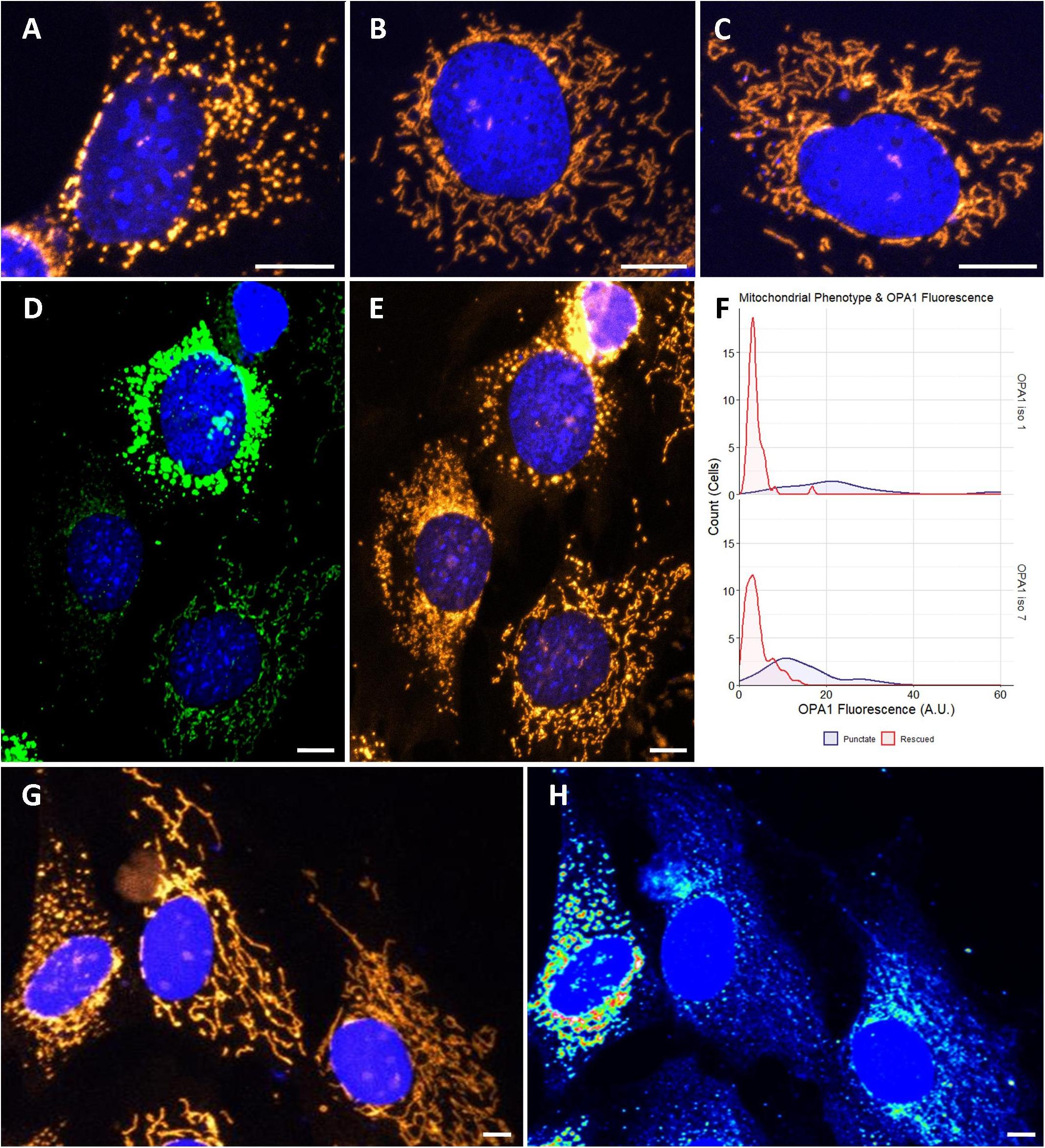 Frontiers | Optimized OPA1 Isoforms 1 and 7 Provide Therapeutic Benefit ...