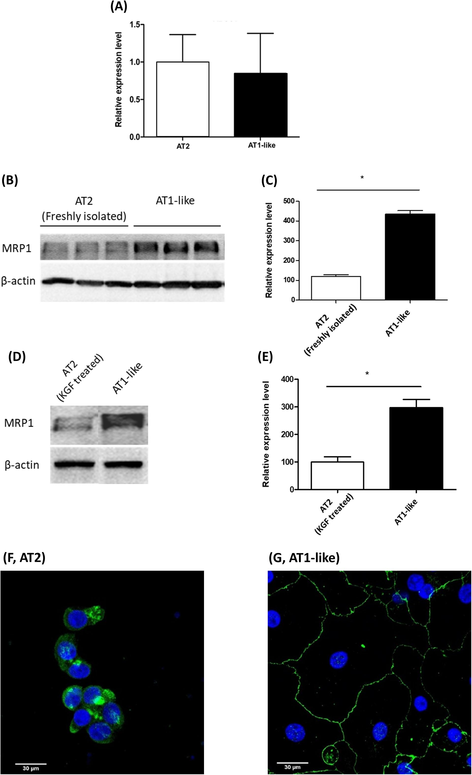 Frontiers Tobacco Smoke And Inhaled Drugs Alter Expression And Activity Of Multidrug Resistance Associated Protein 1 Mrp1 In Human Distal Lung Epithelial Cells In Vitro Bioengineering And Biotechnology