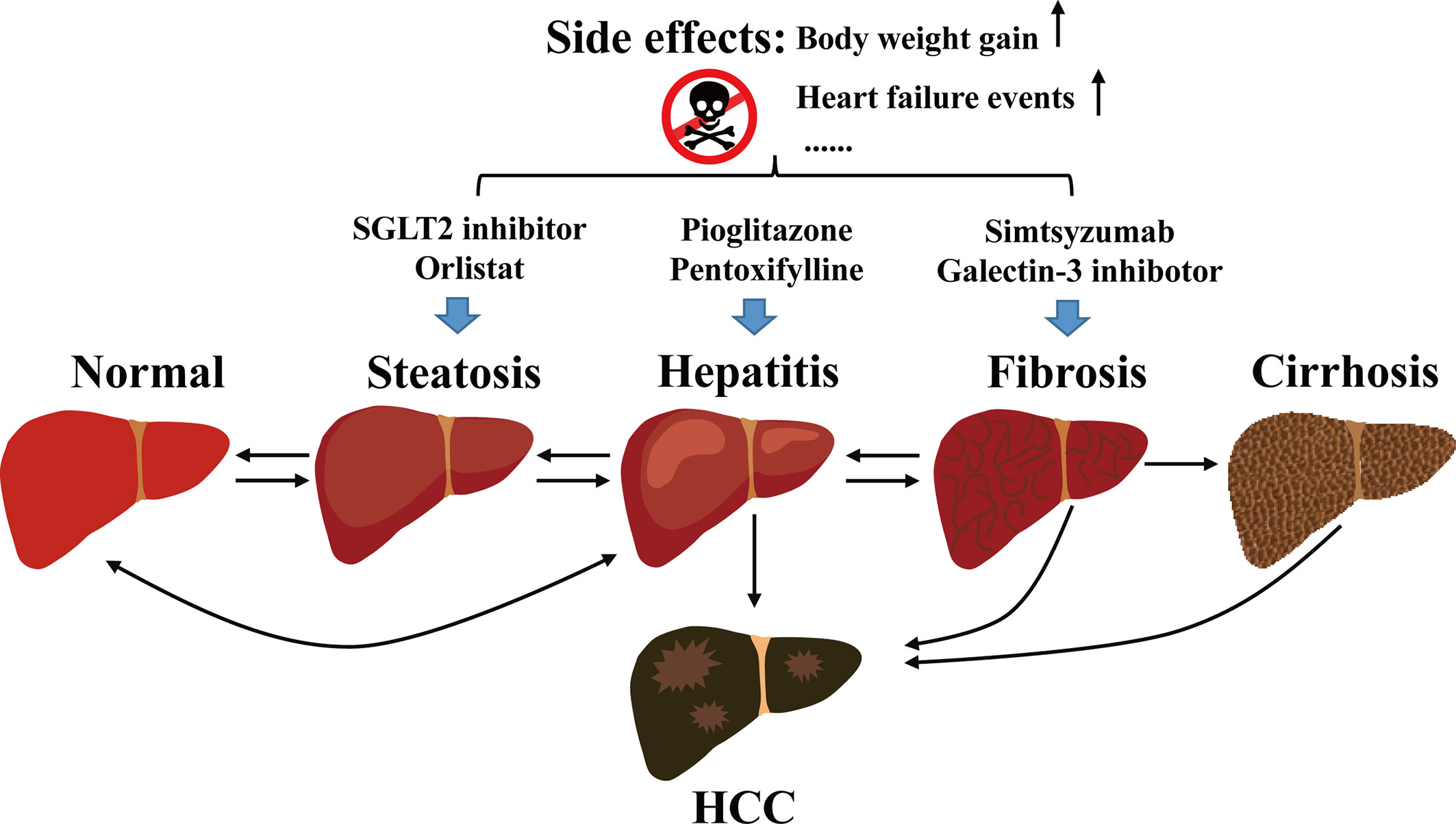 5 natural ways to fight non-alcoholic fatty liver disease – Asian Tribune