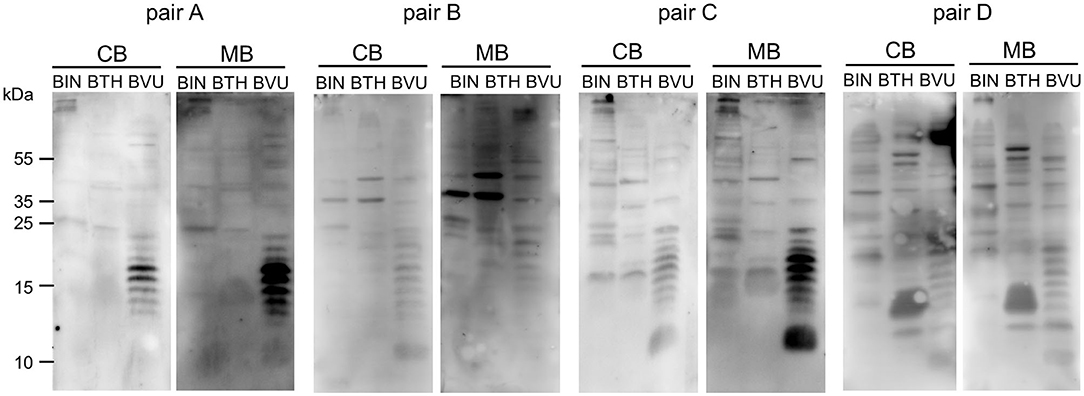 Frontiers Limited Neonatal Carbohydrate-Specific Antibody