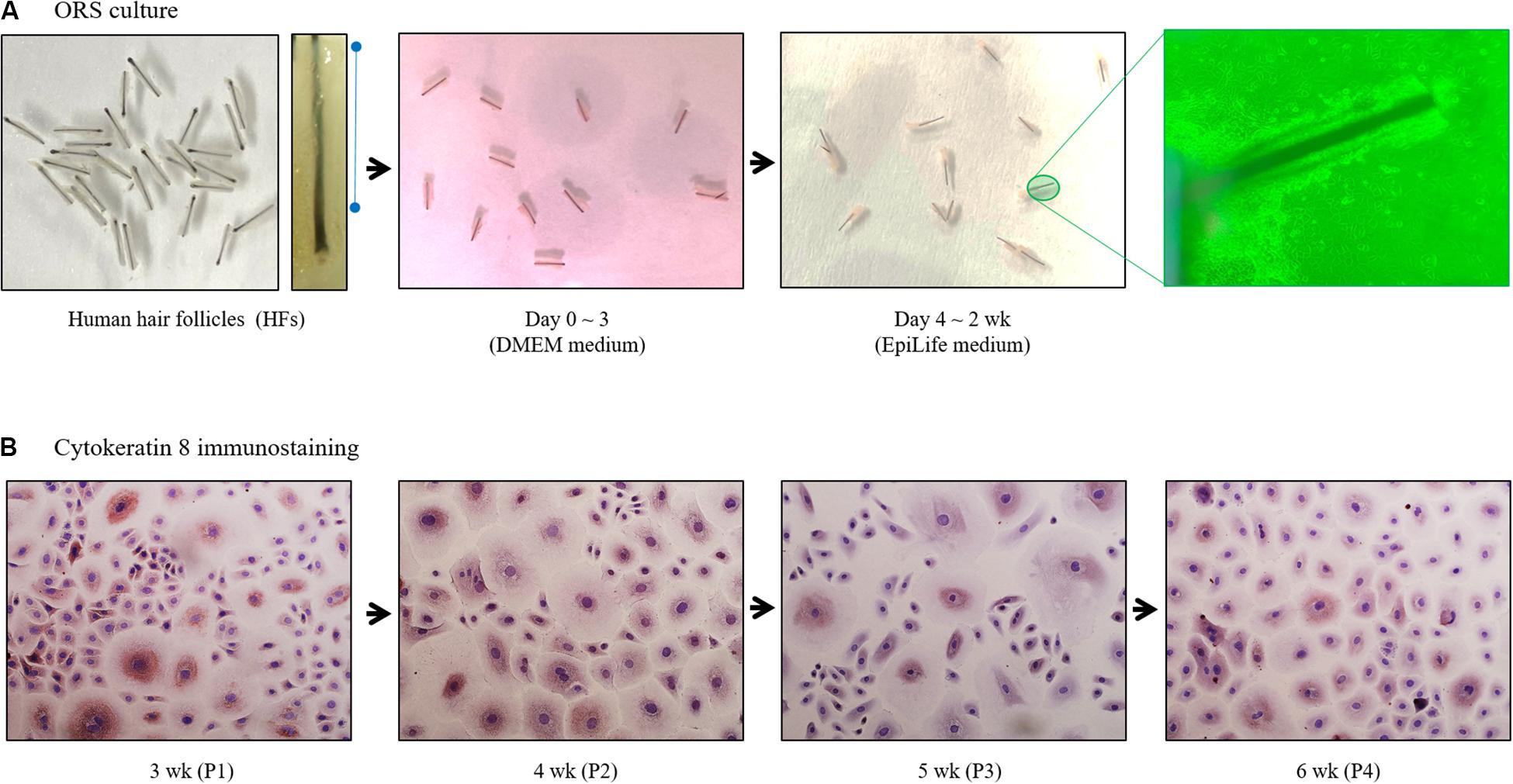 Human hair follicle hotsell