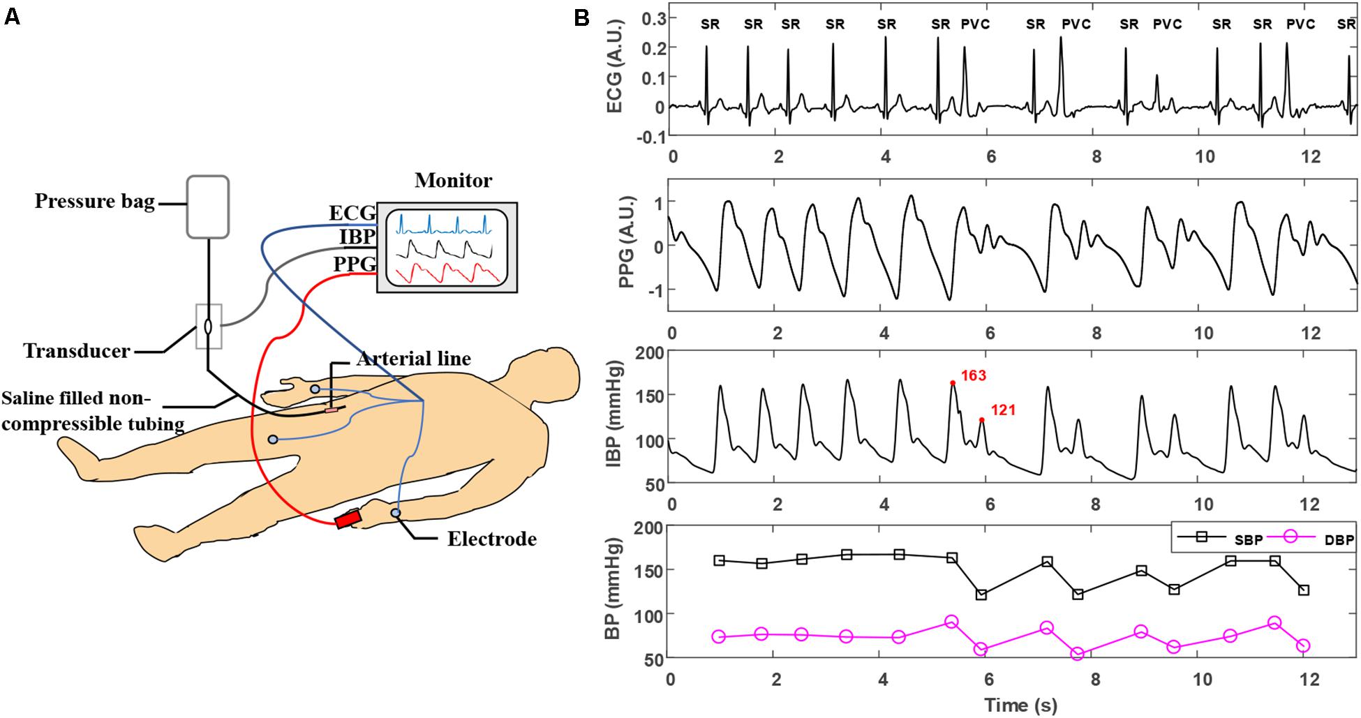 Calculadora frecuencia cardiaca ecg