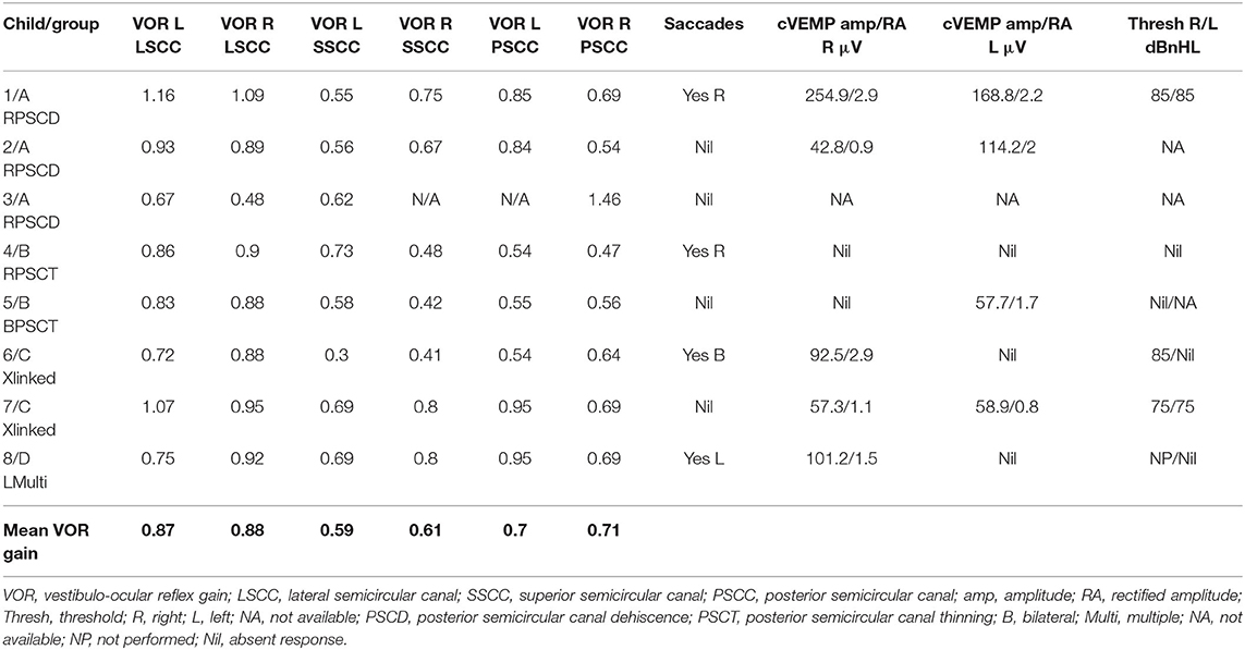 Frontiers  Audiovestibular Quantification in Rare Third Window