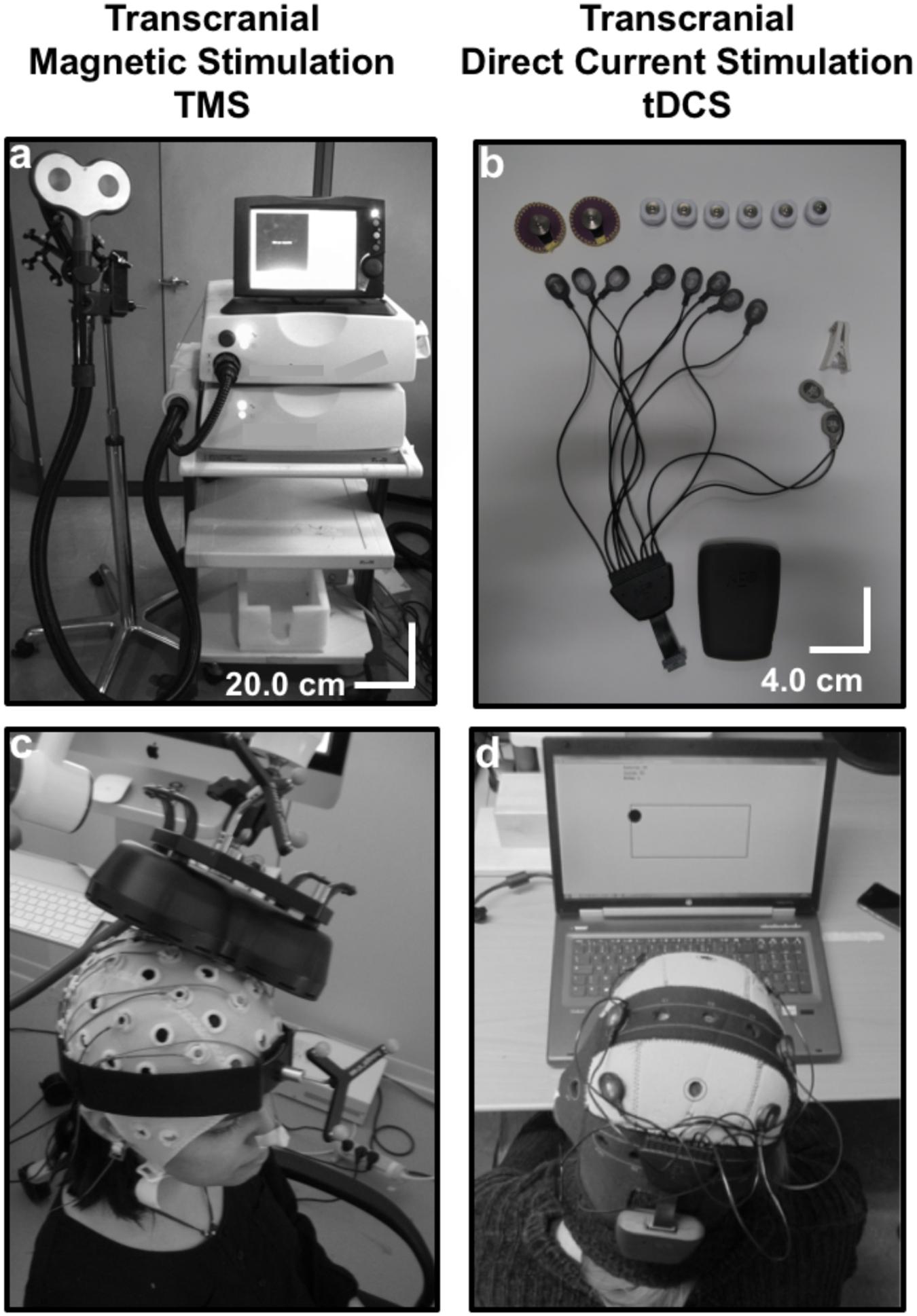 Stim Machine - Stimul8 4-Channel Electrotherapy Machine by