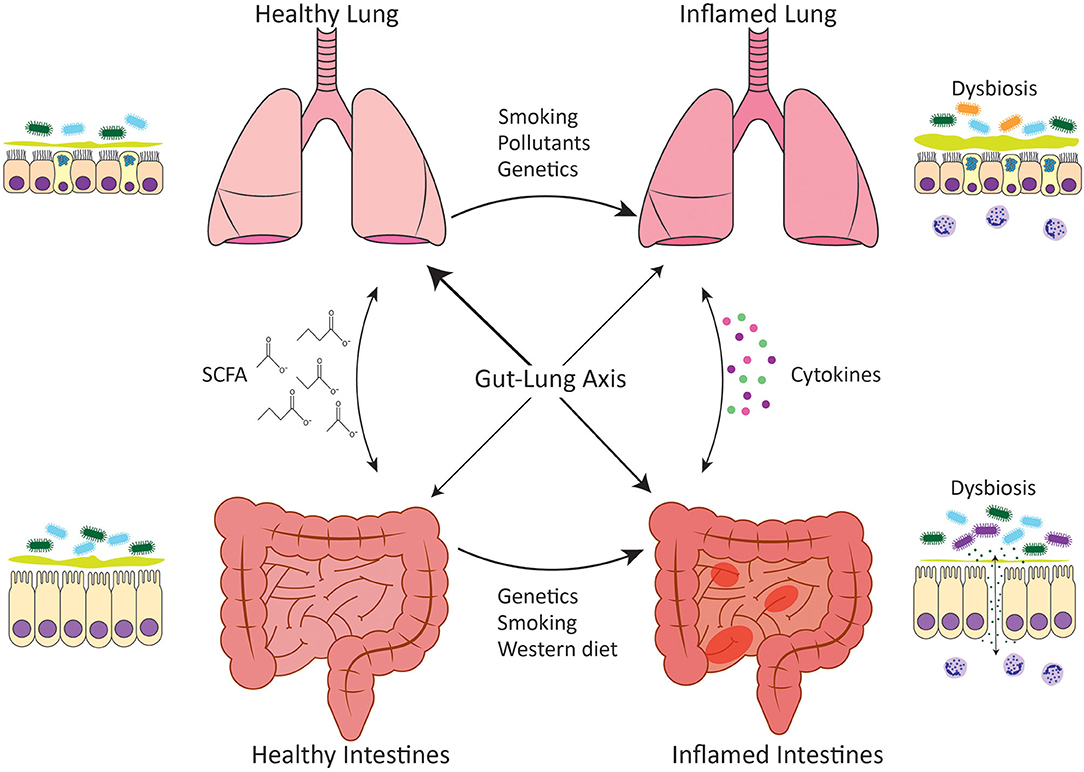 dysbiosis and disease