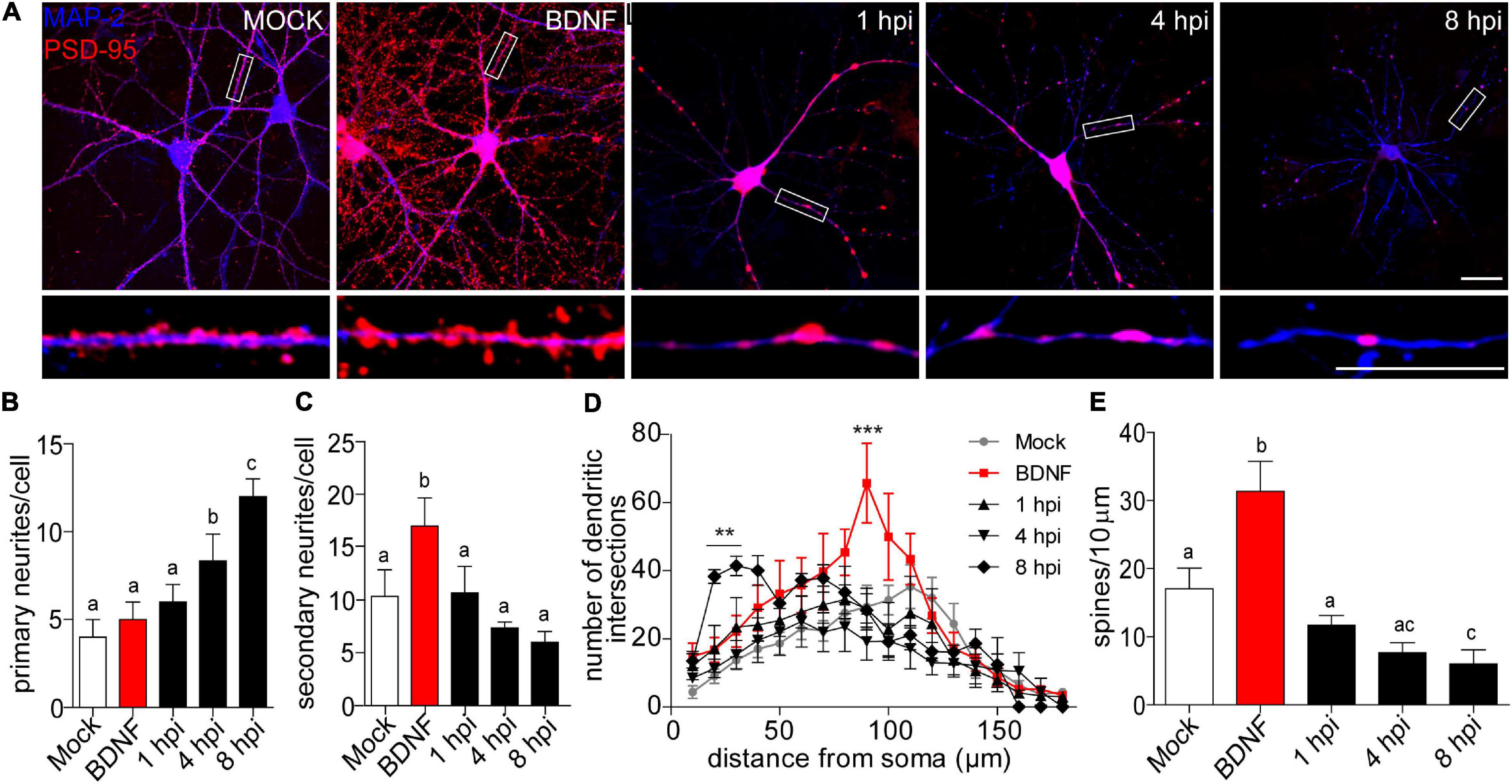 Herpes Simplex Virus-1 in the Brain: The Dark Side of a Sneaky Infection:  Trends in Microbiology