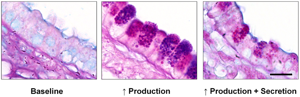 Risultati immagini per mucin-producing cells