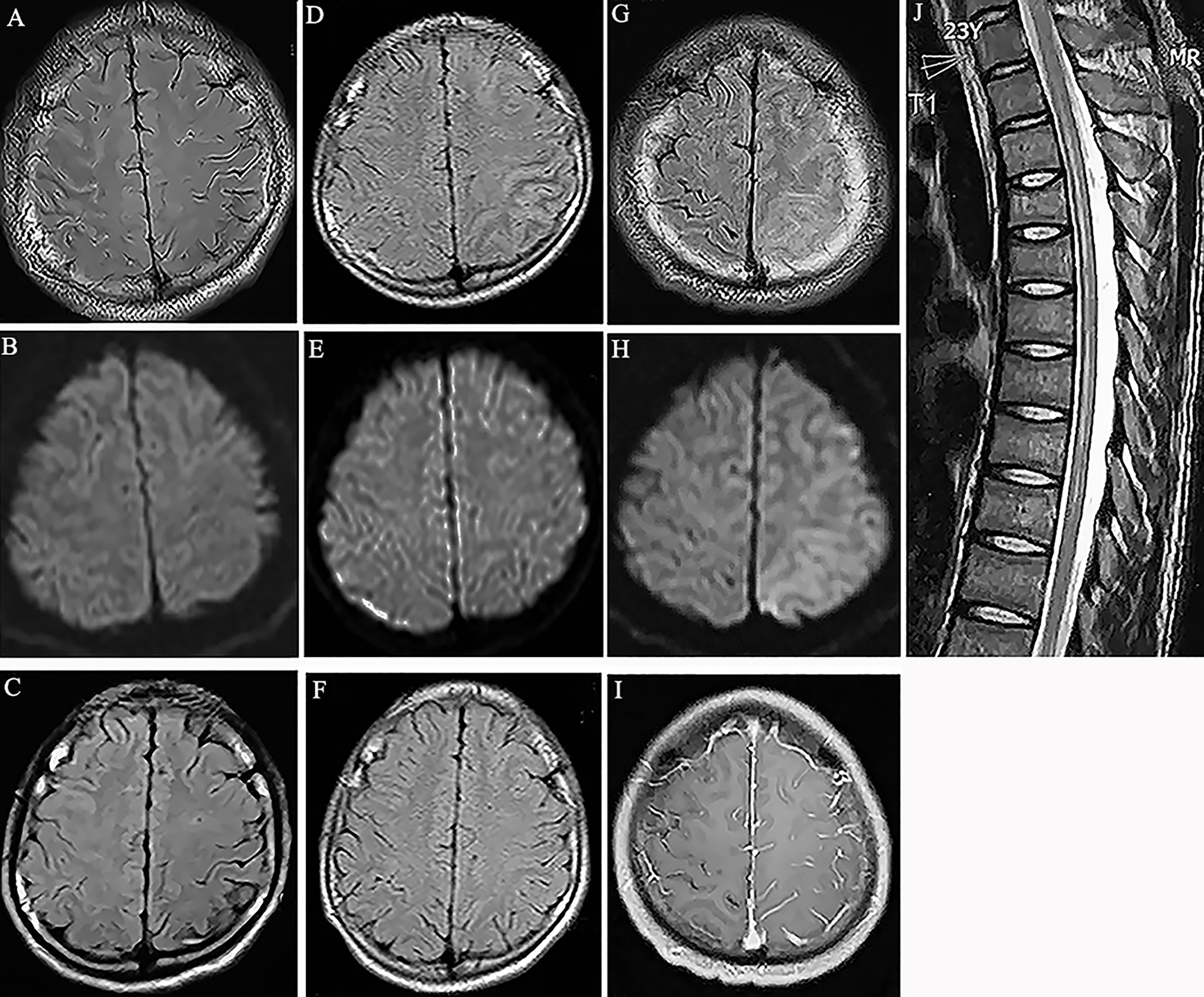 Frontiers  Specific imaging features indicate the clinical