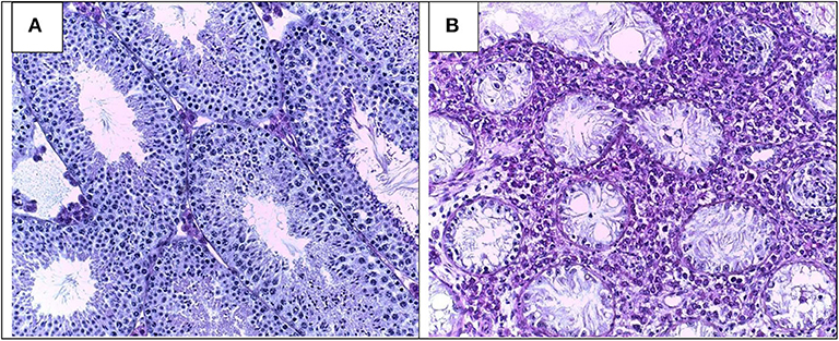 Morphology of Leydig cells in the testes after in vivo MCP-1 treatment.